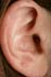 Right Ear